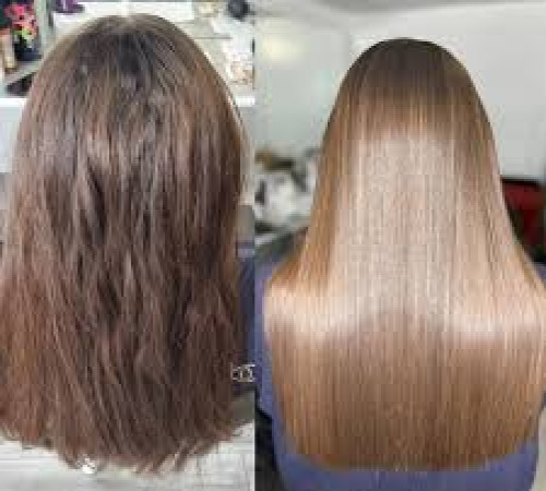 listing category image