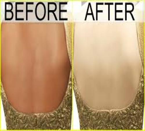 listing category image