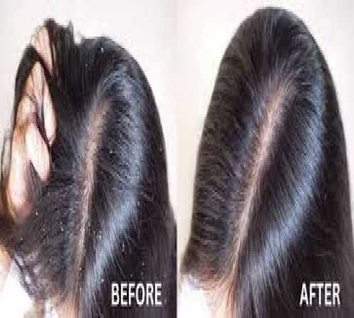 listing category image