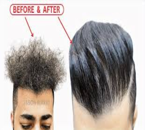 listing category image